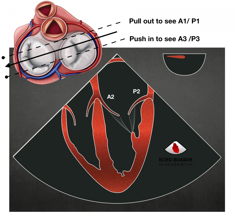 Mitral Valve Anatomy Echoboardsacademy